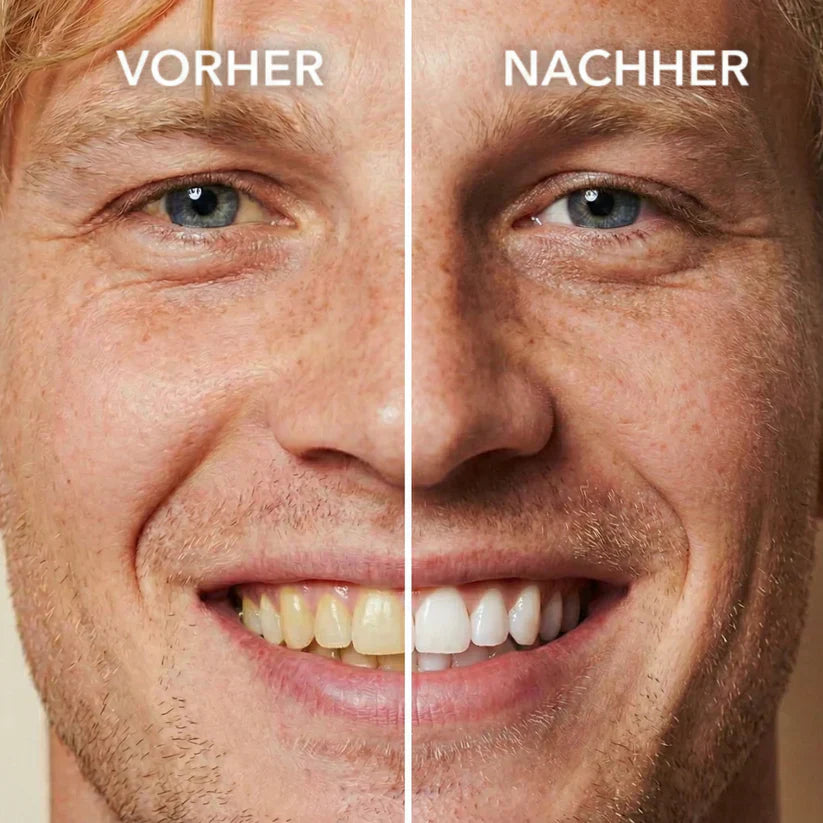 🖤2026 New Year · 40% OFF🖤Tooth Polish - Instant Clean Smile