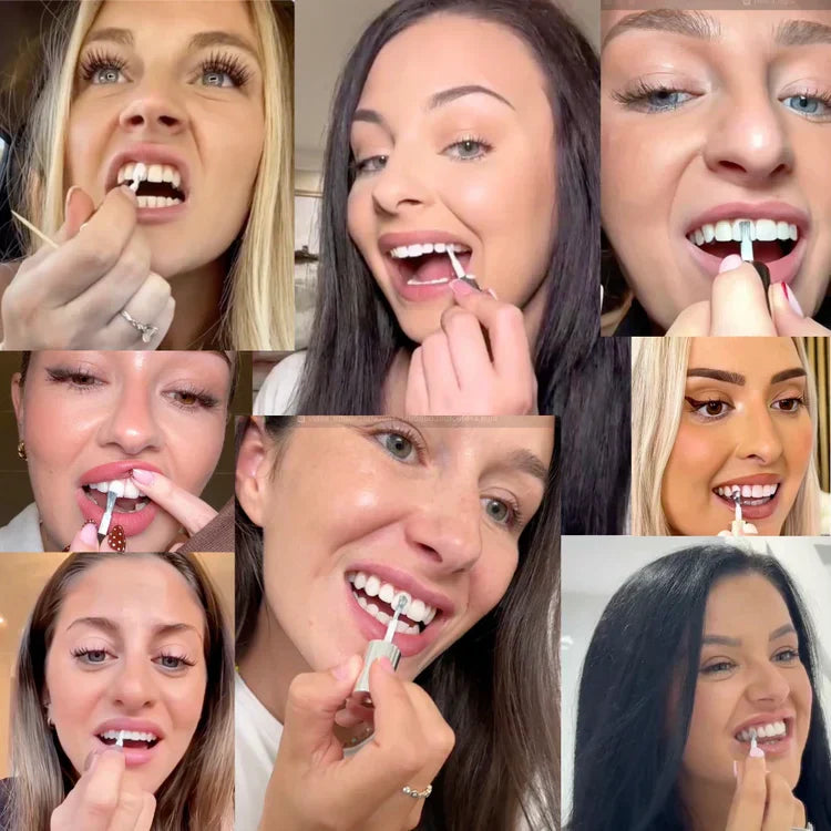 🖤2026 New Year · 40% OFF🖤Tooth Polish - Instant Clean Smile