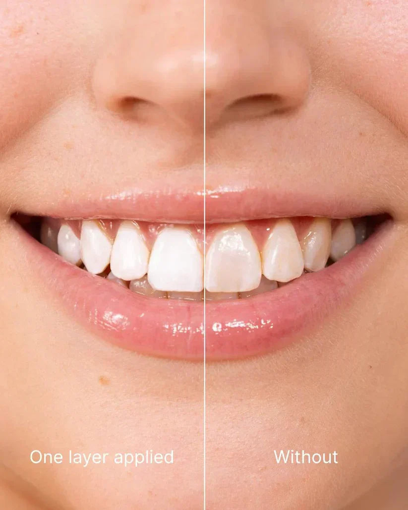 🖤2026 New Year · 40% OFF🖤Tooth Polish - Instant Clean Smile