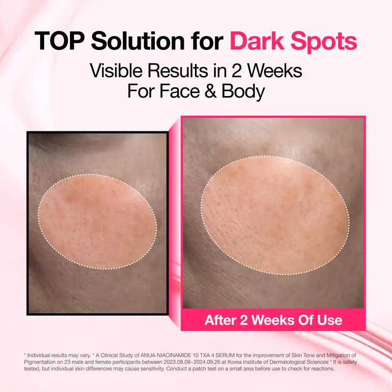 [Anua] Dark Spot Correcting Serum : 10% Niacinamide+ 4% Tranexamic Acid｜Niacinamide Serum, PM Skincare product, Hyperpigmentation, Brightening