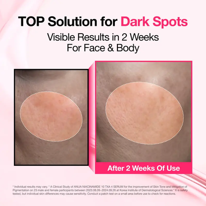 [Anua] Dark Spot Correcting Serum : 10% Niacinamide+ 4% Tranexamic Acid｜Niacinamide Serum, PM Skincare product, Hyperpigmentation, Brightening