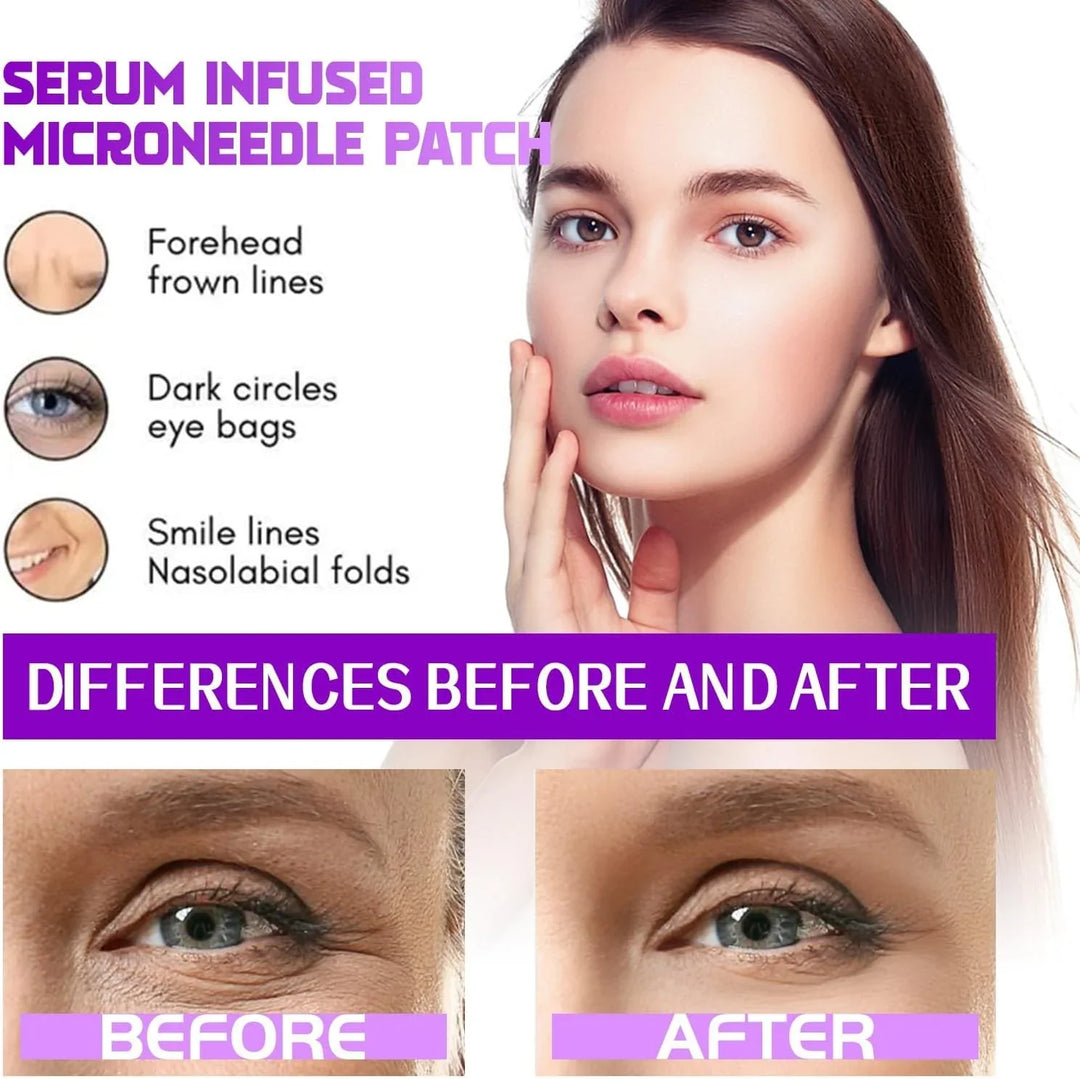 Patches——TARGETS EYE BAGS &amp; DARK CIRCLES