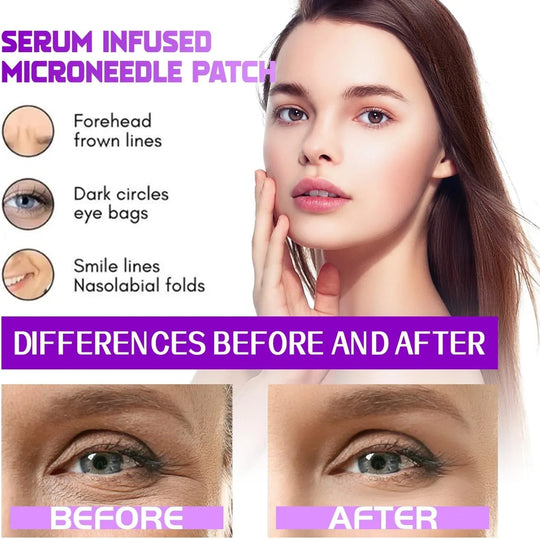 Patches——TARGETS EYE BAGS &amp; DARK CIRCLES