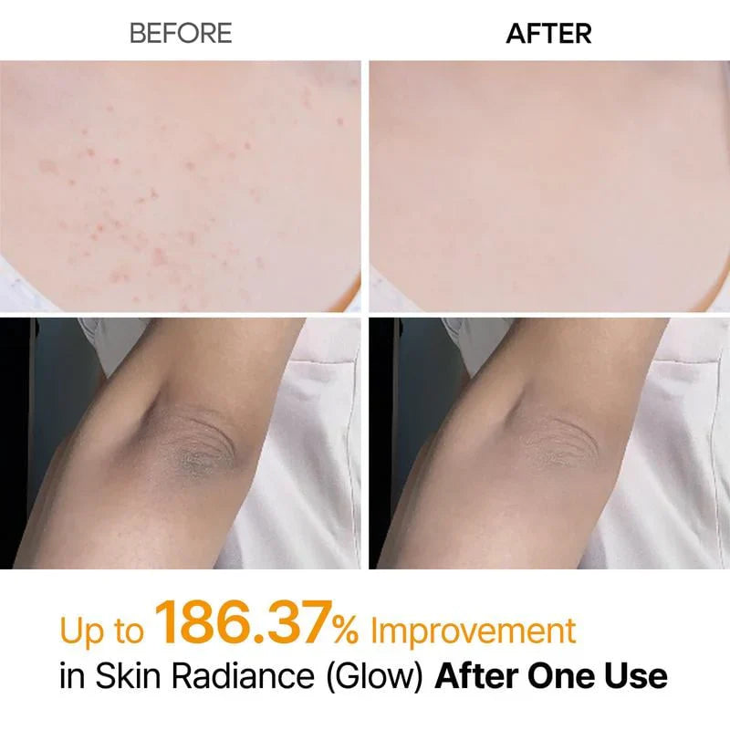 Shot Keratin Care Kojic Acid Turmeric Spray