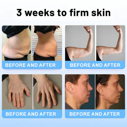 💎ODALIT™ Botox Bee Venom Firming Serum Stick
