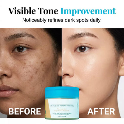 Kojic Acid Turmeric TX Toner Pad 70pads, Dark Spot & Pigmentation Care for Uneven Skin Tone