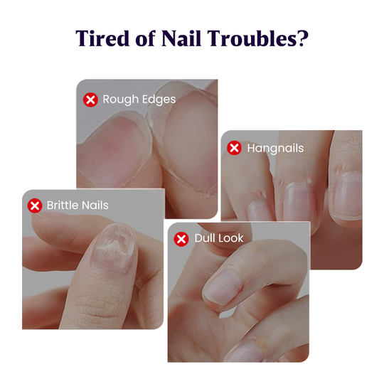 3-in-1 Nail Care Serum Oil Pen – Cuticle Remover, Nail Polish Remover &amp; Nail Oil Treatment