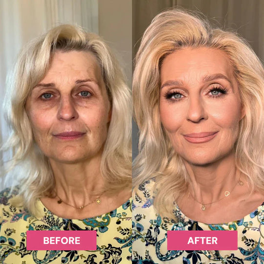 Revive Tired Eyes – Hydrating &amp; Anti-Wrinkle Eye Balm