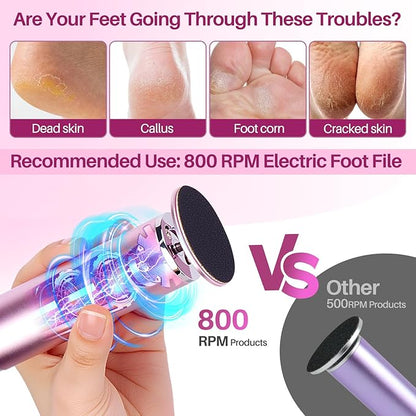 LIONVISON Electric Foot Callus Remover