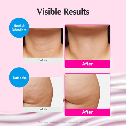 EQQUALBERRY NAD+ Peptide Boosting Cream – NAD+ 5% & 13 Peptides Anti-Aging Korean Skincare Face & Body Cream | Firming & Lifting Pink Neck Cream for Sagging Skin