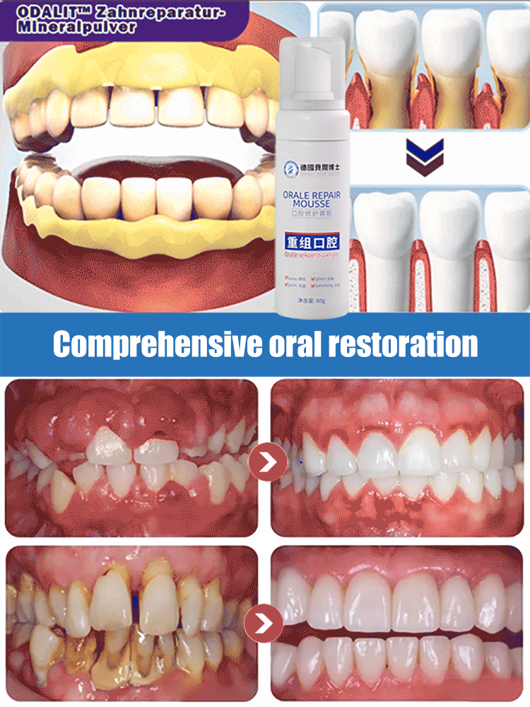 🖤2026 New Year · 40% OFF🖤Medical Grade Recombinant Oral Repair Mousse
