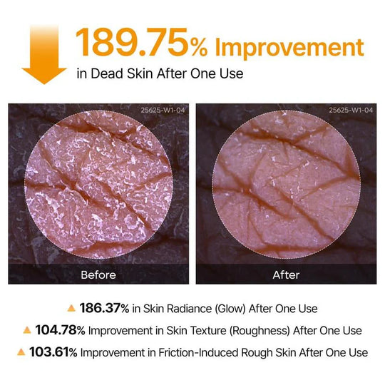Shot Keratin Care Kojic Acid Turmeric Spray