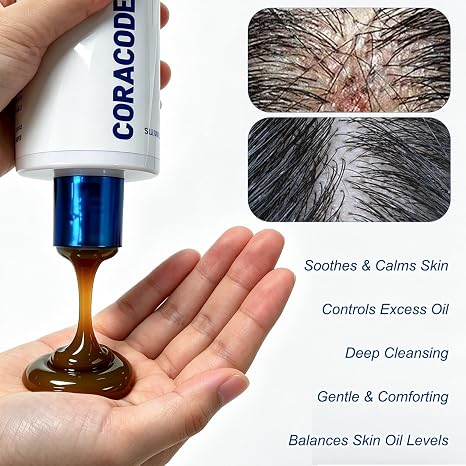Folliculitis Shampoo for Itchy, Flaky Scalp - Purifying Formula for a Soothed, Balanced Scalp &amp; Oily Scalp Care, Men &amp; Women