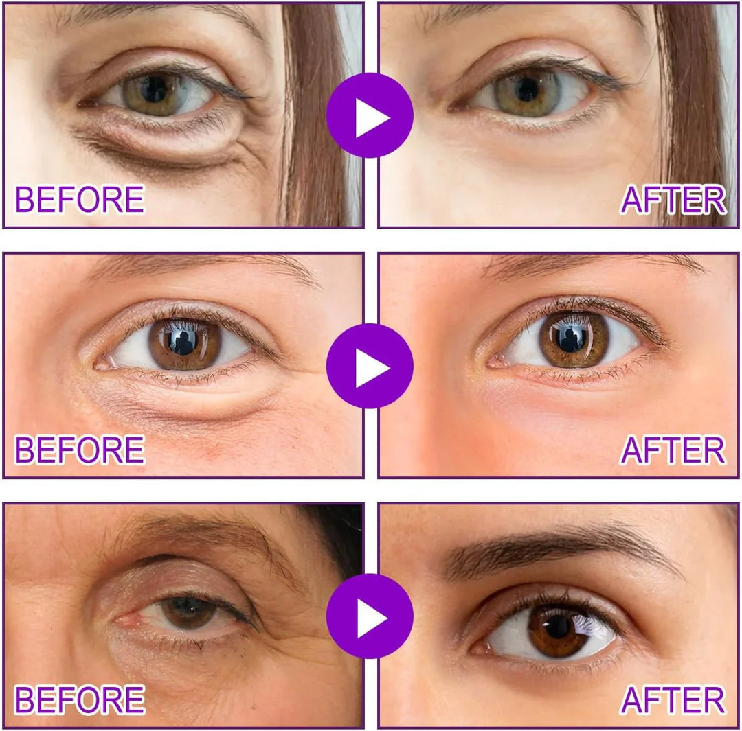 Patches——TARGETS EYE BAGS &amp; DARK CIRCLES