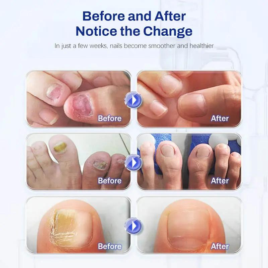 Non-Sticky Moisturizing Nail Care Drops