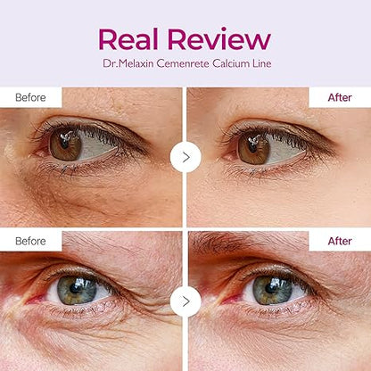 Dr.Melaxin Calcium Volume Eye Patches – Firming Hydrogel Under Eye Masks for Puffiness Fine Lines, Deep Hydration