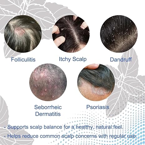 Folliculitis Shampoo for Itchy, Flaky Scalp - Purifying Formula for a Soothed, Balanced Scalp &amp; Oily Scalp Care, Men &amp; Women