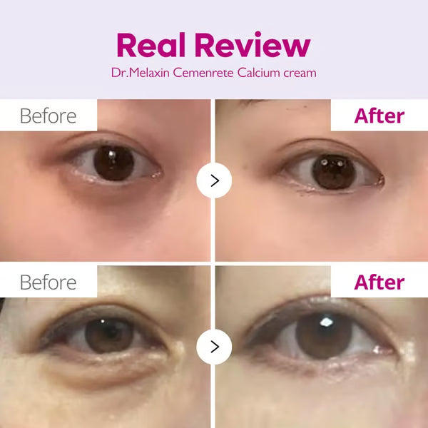 🖤2026 New Year · 40% OFF🖤Calcium Concentrated Repair Cream
