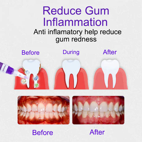 ✨ Teeth Whitening Serum Pen 😁