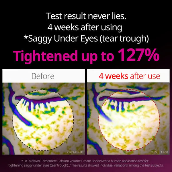 🖤2026 New Year · 40% OFF🖤Calcium Concentrated Repair Cream