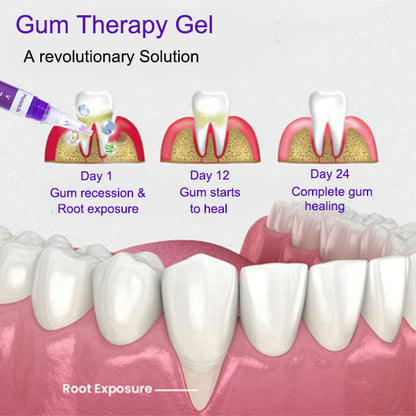 ✨ Teeth Whitening Serum Pen 😁