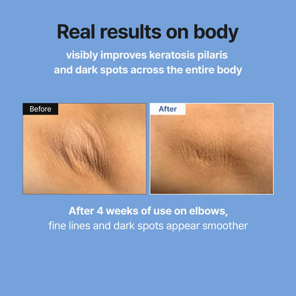 MEDITHERAPY Retinal Skin Booster Serum | Retinaldehyde, Niacinamide Anti-Aging Serum