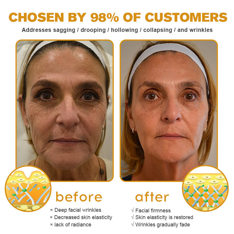 🖤2026 New Year · 40% OFF🧑‍⚕️TLOPA® Botox Bee Venom Wrinkle Removal Cream