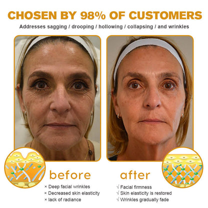 🖤2026 New Year · 40% OFF🧑‍⚕️TLOPA® Botox Bee Venom Wrinkle Removal Cream