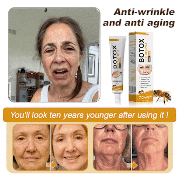 🖤2026 New Year · 40% OFF🧑‍⚕️TLOPA® Botox Bee Venom Wrinkle Removal Cream