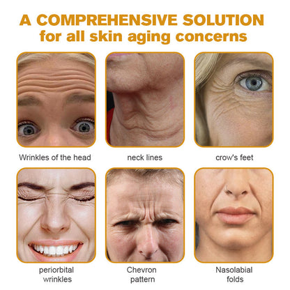 🖤2026 New Year · 40% OFF🧑‍⚕️TLOPA® Botox Bee Venom Wrinkle Removal Cream