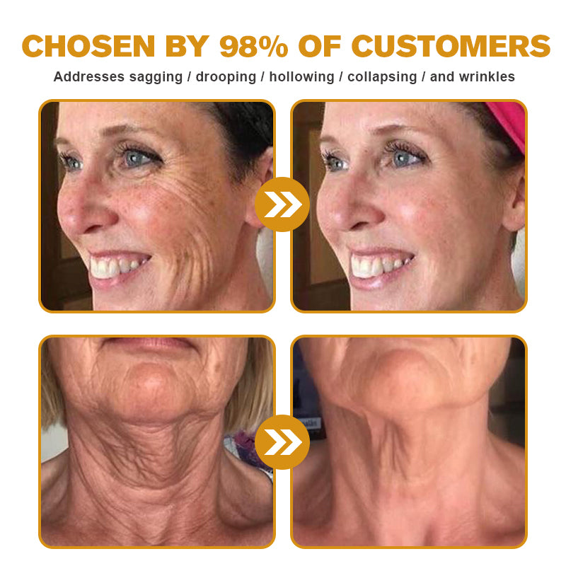 🖤2026 New Year · 40% OFF🧑‍⚕️TLOPA® Botox Bee Venom Wrinkle Removal Cream