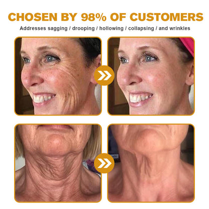 🖤2026 New Year · 40% OFF🧑‍⚕️TLOPA® Botox Bee Venom Wrinkle Removal Cream