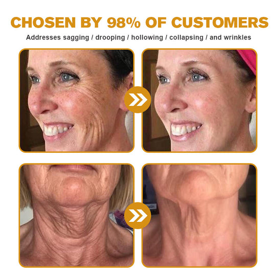 🖤2026 New Year · 40% OFF🧑‍⚕️TLOPA® Botox Bee Venom Wrinkle Removal Cream