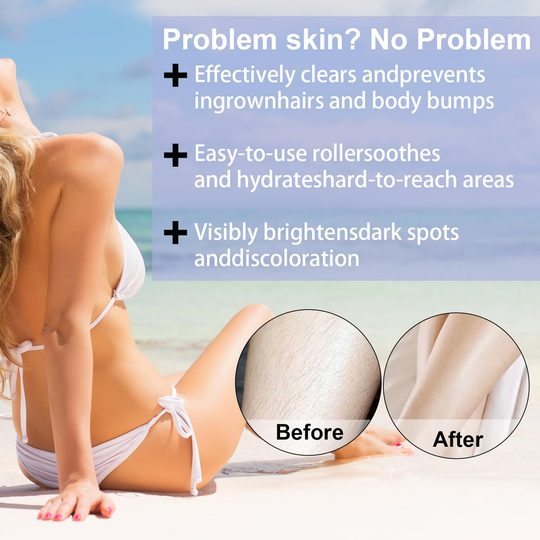 Smoothing Solution Ingrown Hair Treatment