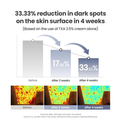 AXIS-Y TXA 2.5% Intensive Brightening Cream – Tranexamic Acid Moisturizer with Niacinamide and Glutathione for Dark Spots and Uneven Skin Tone