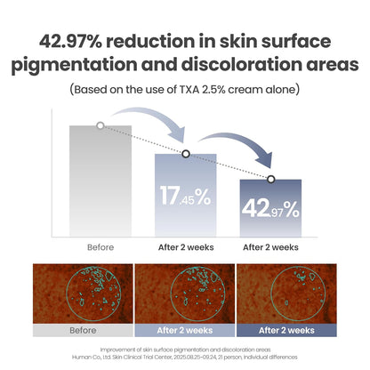 AXIS-Y TXA 2.5% Intensive Brightening Cream – Tranexamic Acid Moisturizer with Niacinamide and Glutathione for Dark Spots and Uneven Skin Tone