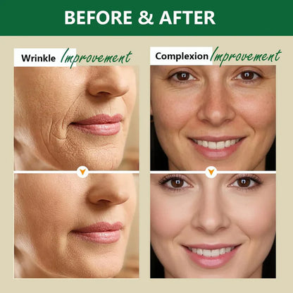 Aussie Betta Golden Micro-Peptide Tallow Serum-Gentle Anti-Aging for Sensitive Skin