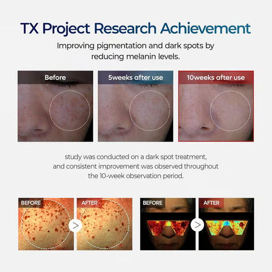 🧴 TX Cream, Tranexamic Acid &amp; Niacinamide Dark Spot &amp; Hyperpigmentation Care