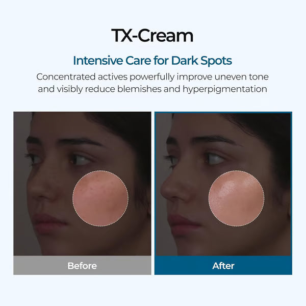 🧴 TX Cream, Tranexamic Acid &amp; Niacinamide Dark Spot &amp; Hyperpigmentation Care