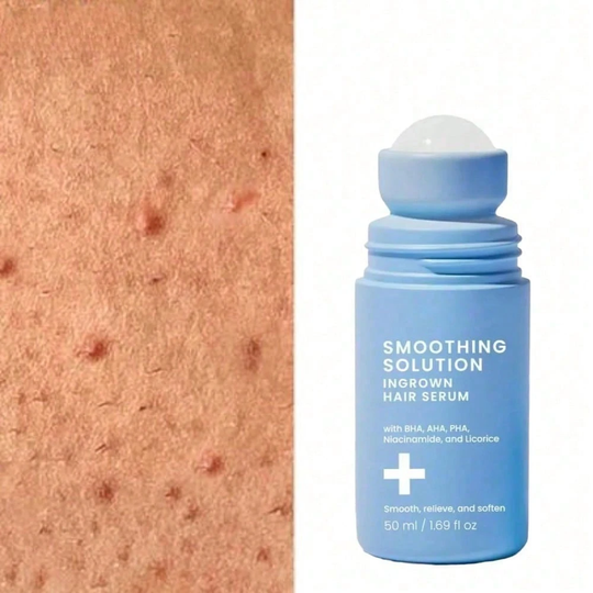 Smoothing Solution Ingrown Hair Treatment