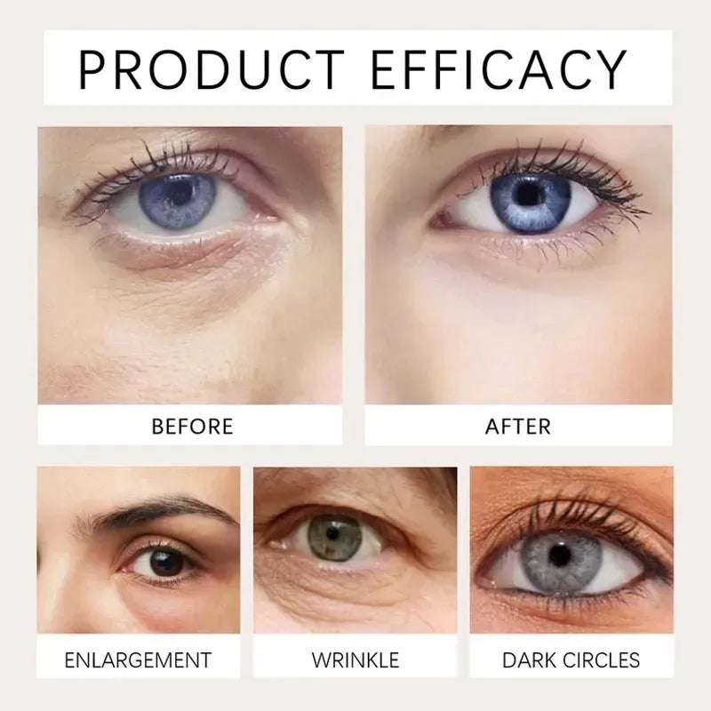 Elycura™ Flattens the Look of Under-Eye Bags in 10 Seconds