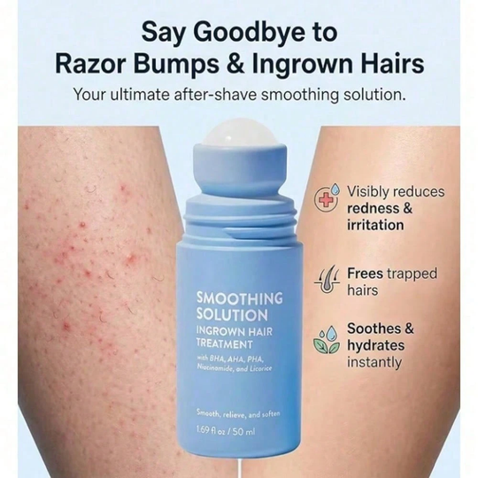 Smoothing Solution Ingrown Hair Treatment
