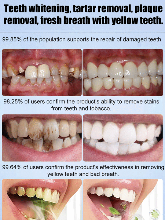 🖤2026 New Year · 40% OFF🖤Medical Grade Recombinant Oral Repair Mousse