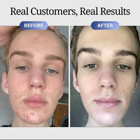 GHK-Cu Peptides Serum, Copper Peptides Serum for Face - Tightening, Repairing, Collagen Boosting - with Hyaluronic Acid - Fragrance-Free