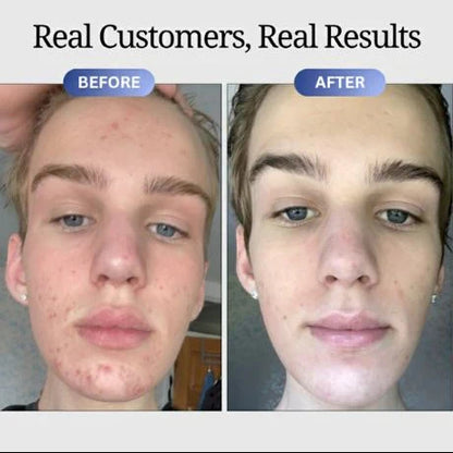 GHK-Cu Peptides Serum, Copper Peptides Serum for Face - Tightening, Repairing, Collagen Boosting - with Hyaluronic Acid - Fragrance-Free