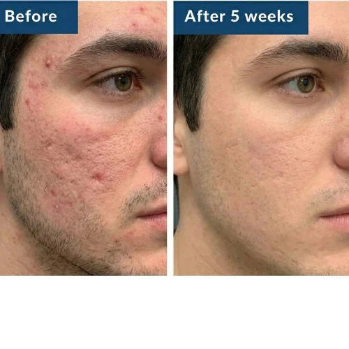 GHK-Cu Peptides Serum, Copper Peptides Serum for Face - Tightening, Repairing, Collagen Boosting - with Hyaluronic Acid - Fragrance-Free