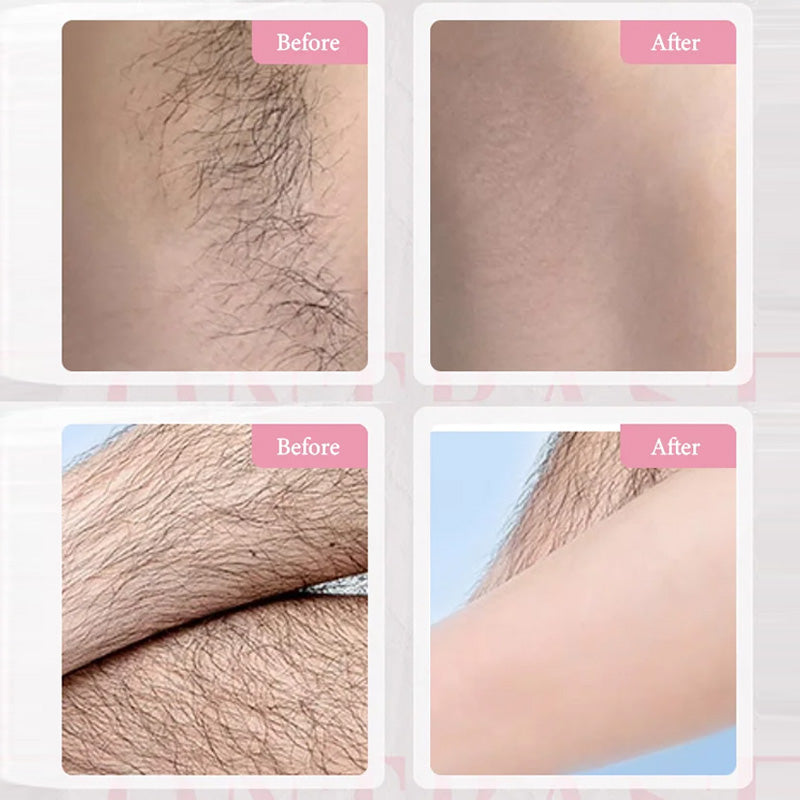 Gentle &amp; Effective Hair Removal Cream
