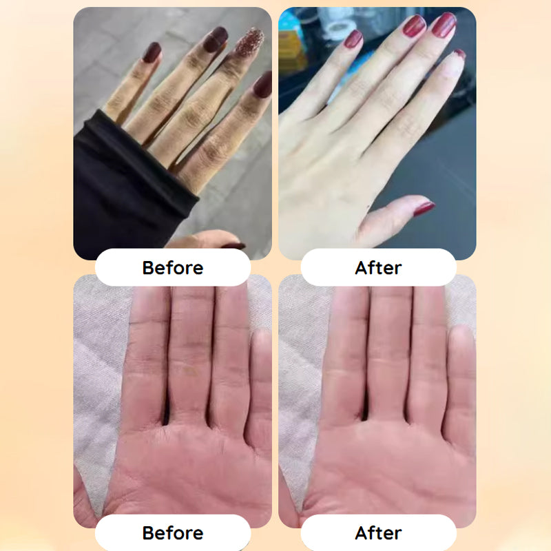 💞50K+ SOLD!💧Fresh Hydrating Hand Cream – Instant relief for dry hands! Deep moisture that lasts, leaving skin soft &amp; supple all day