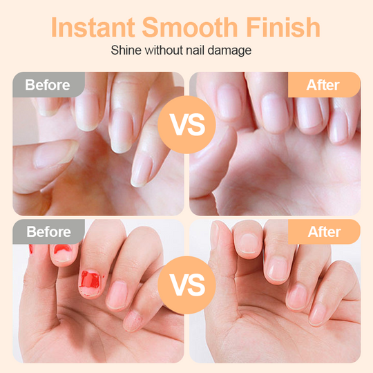 ✂️ LIMITED-TIME 50% OFF! 💅 2-in-1 Smart Electric Nail Clipper &amp; Polisher 🌟