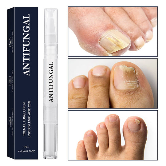 🖤2026 New Year · 40% OFF🖤Toenail Fungus Treatment Pen for Damaged Nails